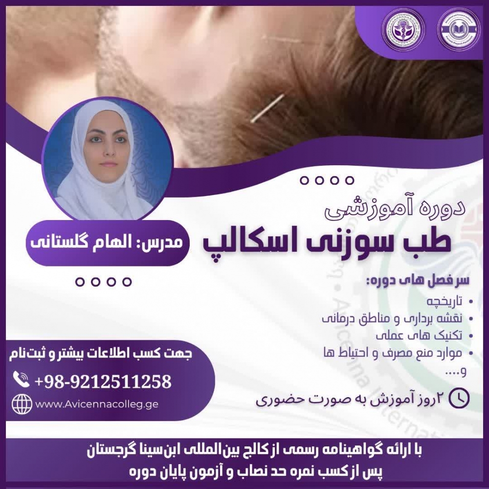 طب سوزنی اسکالپ
